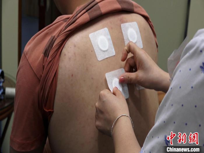 圖為醫(yī)生正在為民眾貼“三伏貼”?！√莆登?攝